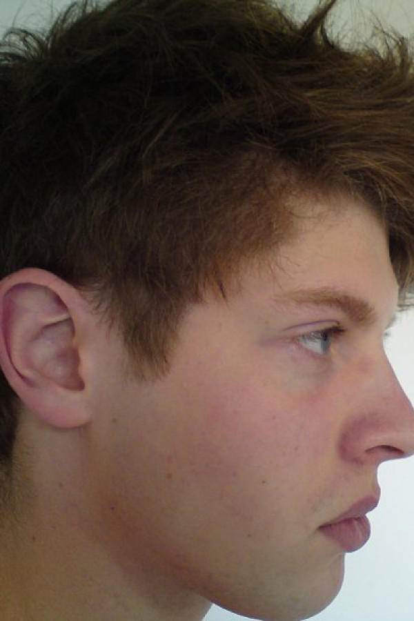 Bullet Models model ID: 2260